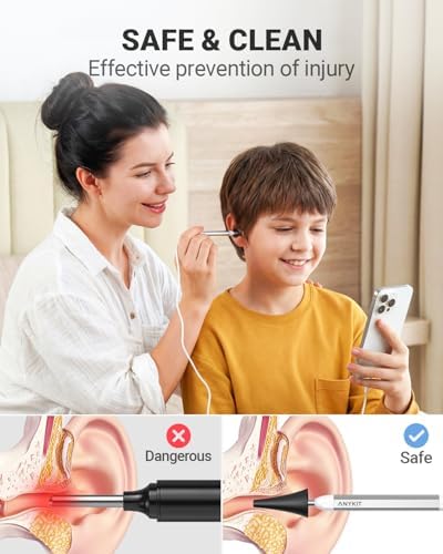 Anykit Digital Otoscope Compatible with Android Devices, Ear Camera with Ear Wax Removal Tools, Video Ear Scope Otoscope with Light, Capture Photos and Videos (Silver)