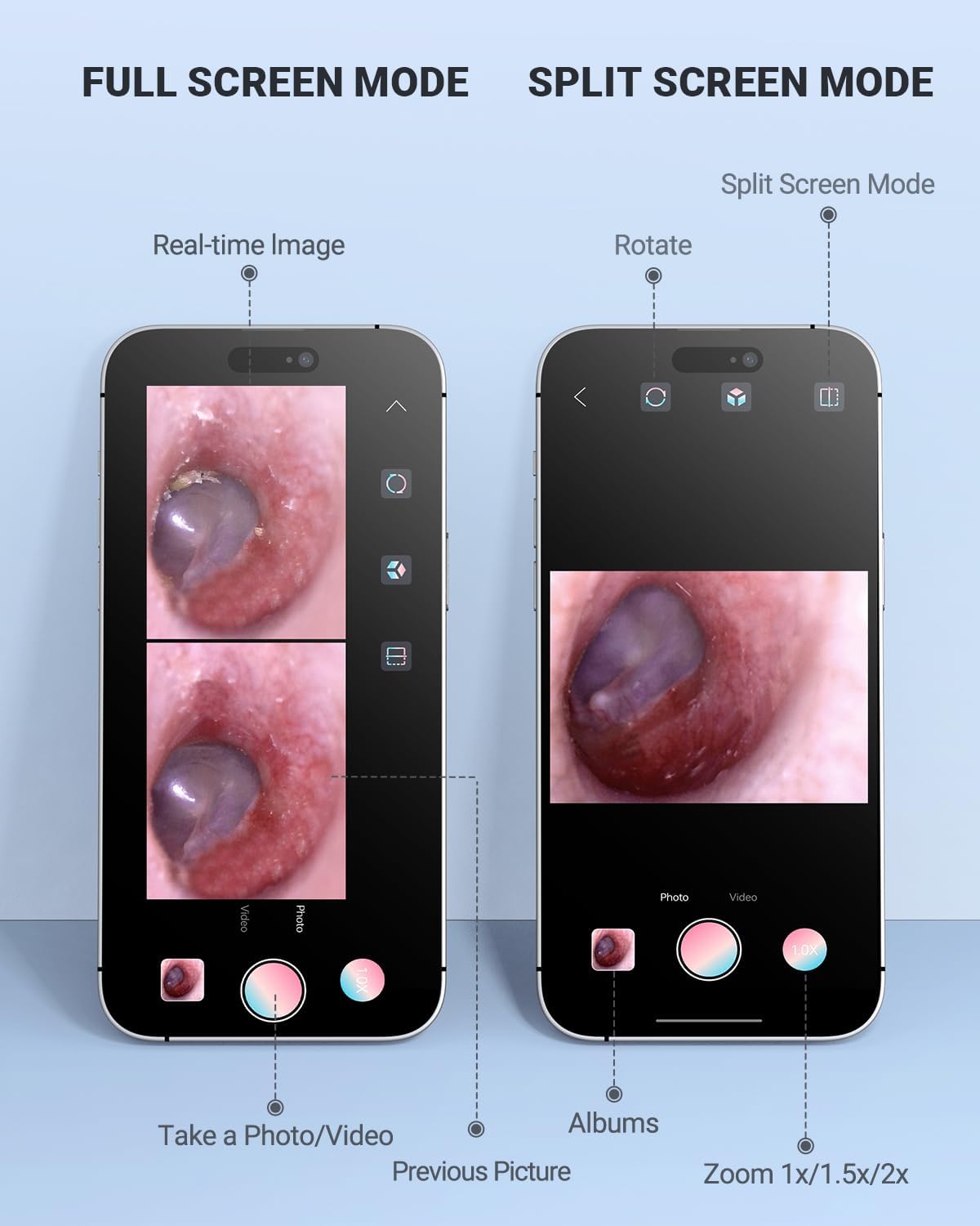 Anykit Digital Otoscope Compatible with Android Devices, Ear Camera with Ear Wax Removal Tools, Video Ear Scope Otoscope with Light, Capture Photos and Videos (Silver)