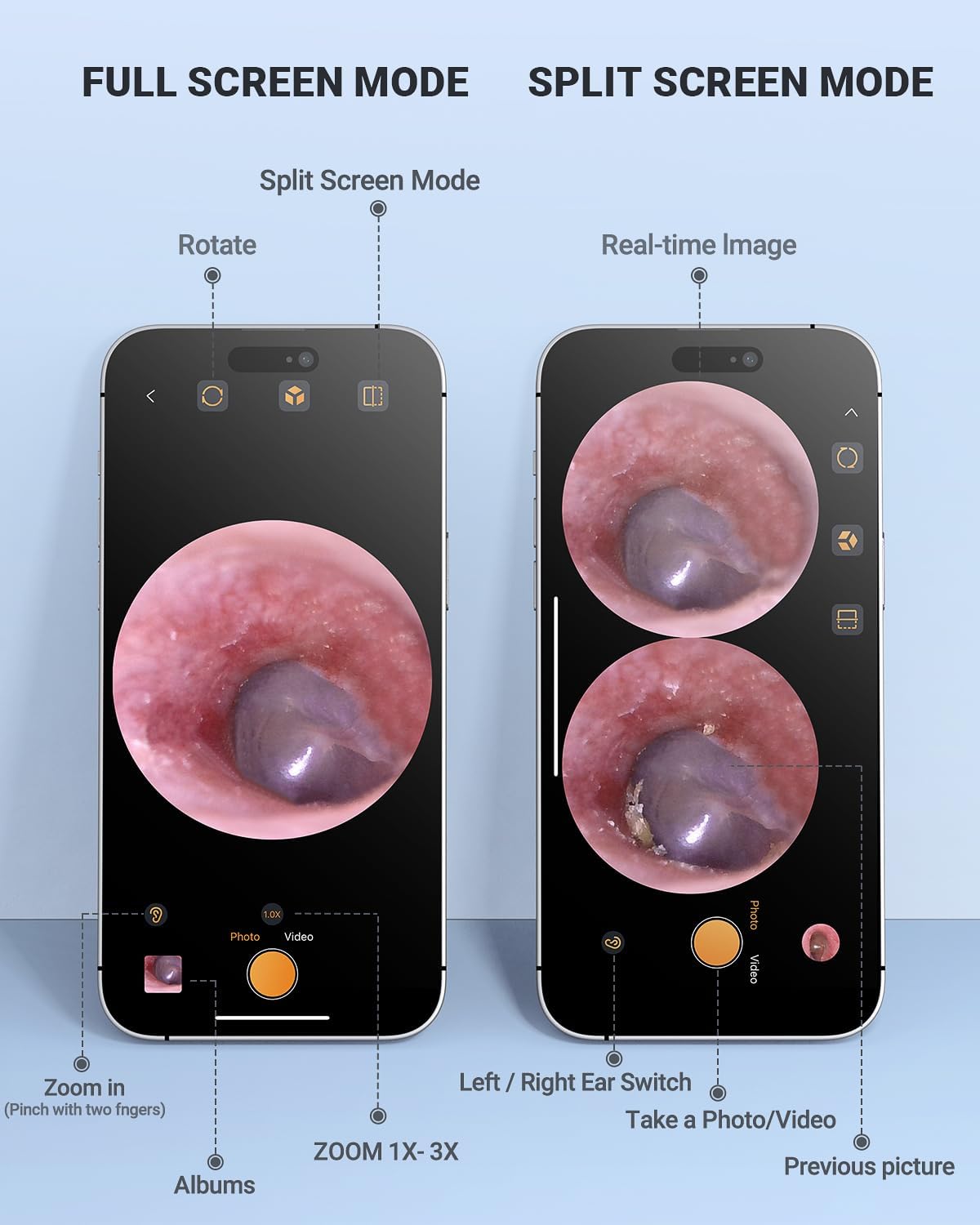 Digital Otoscope Compatible with iPhone & Android, Video Ear Scope Camera | Otoscope with Light, 3.9mm Lens, Plug & Play, Photo & Video, Split-screen, Earwax Removal Kit for Home Cleaning Checking
