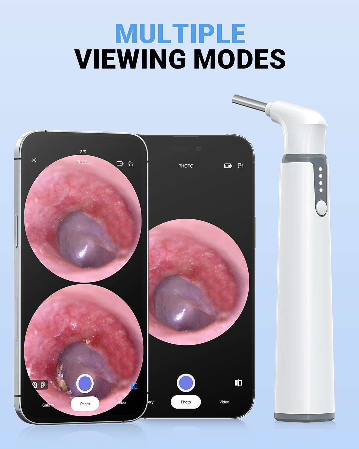 WiFi Otoscope, HD Otoscope Camera with Light, Ear Checker for Kids & Adults | Wireless Ear Scope, Compatible with iPhone & Android, 3.9mm Thin lens, 6 LED lights, Split-Screen View, Photo & Video Taking