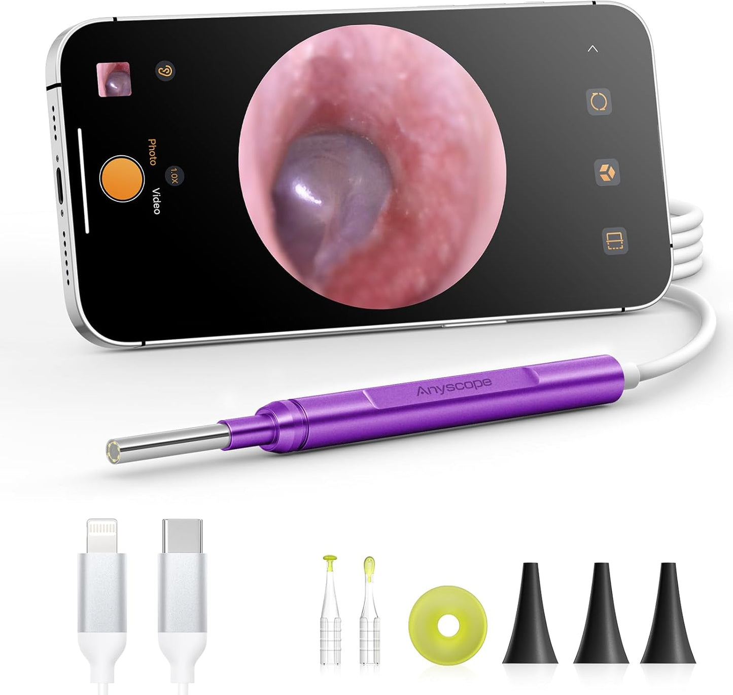 Digital Otoscope Compatible with iPhone & Android, Video Ear Scope Camera | Otoscope with Light, 3.9mm Lens, Plug & Play, Photo & Video, Split-screen, Earwax Removal Kit for Home Cleaning Checking