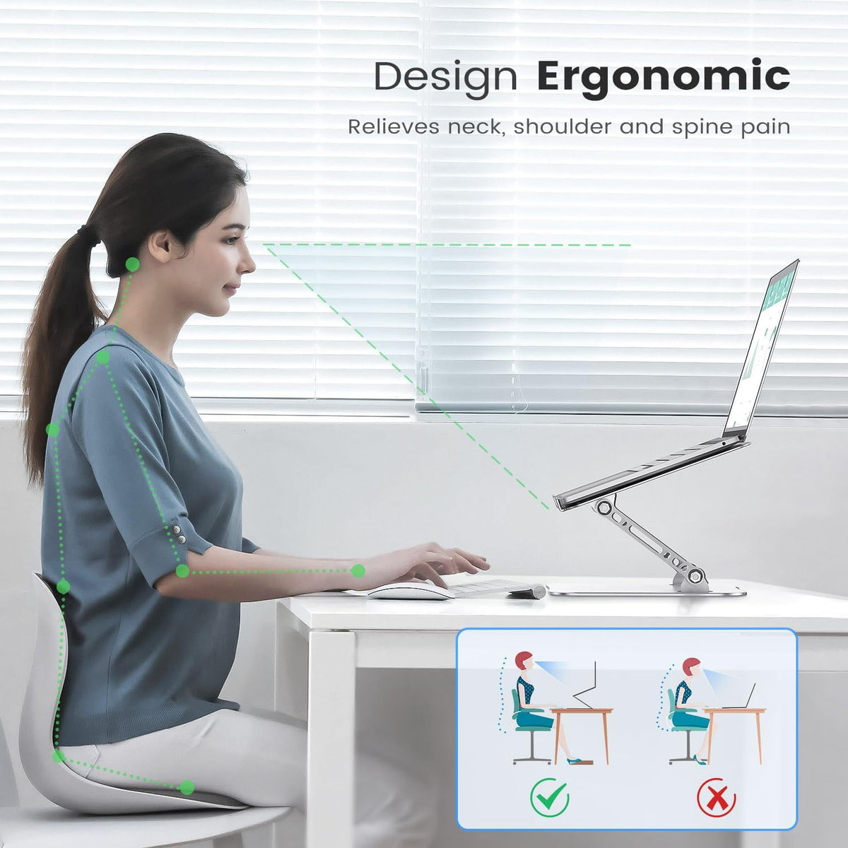 Orlian Adjustable Aluminum Laptop Stand for Desk, Laptop Riser for 11-16"